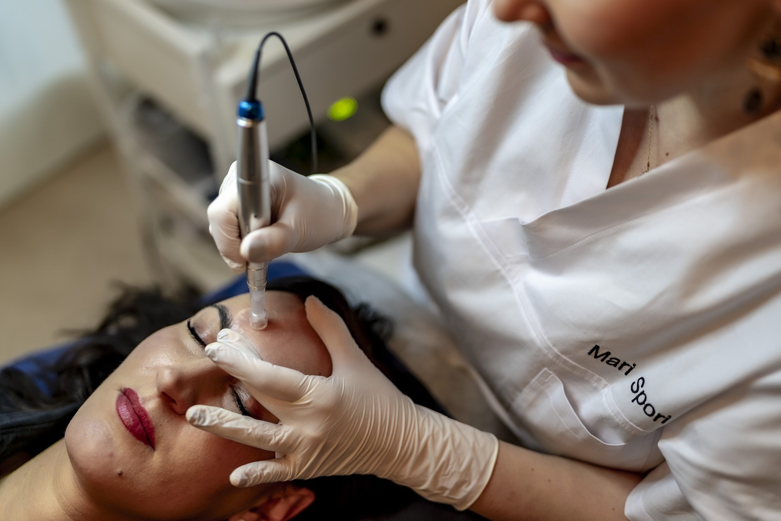 Microneedling Behandlungsbild